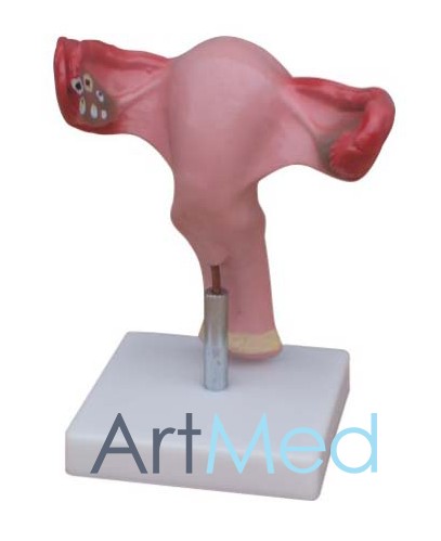 Região Uterina ART-436A | ArtMed