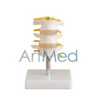 Modelo Anatómico Médico Região Lombar 3 peças ARTMED