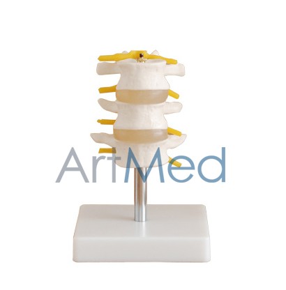 Modelo Anatómico Médico Região Lombar 3 peças ARTMED