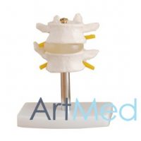 Coluna Vertebral Lombar com Discos Intervertebrais (2 Vértebras) ART-116 | ArtMed